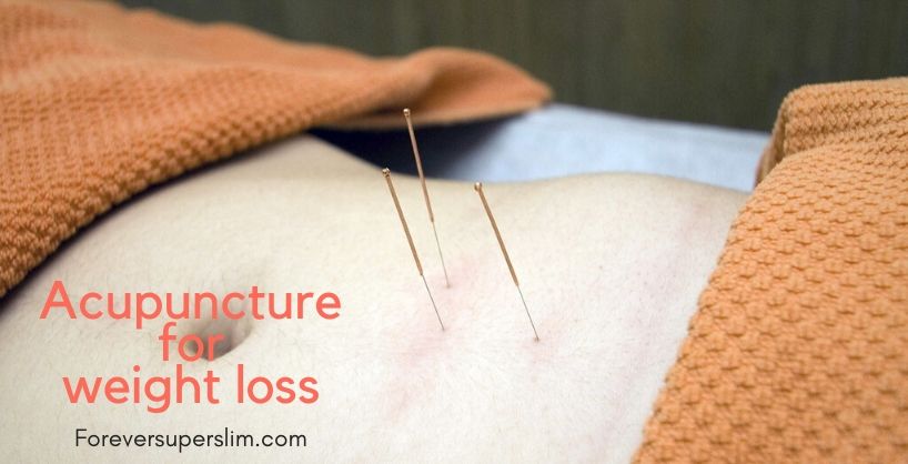 Acupuncture for weight loss; benefits and why you should be cautious.