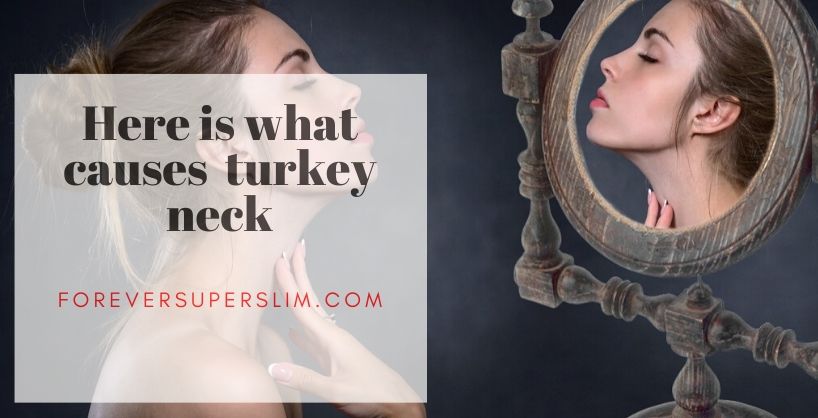 What causes turkey neck?