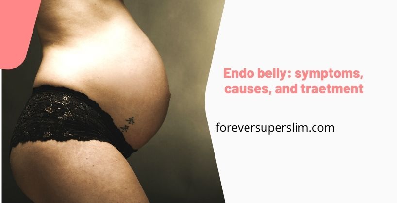 Endo belly: symptoms, causes and treatment